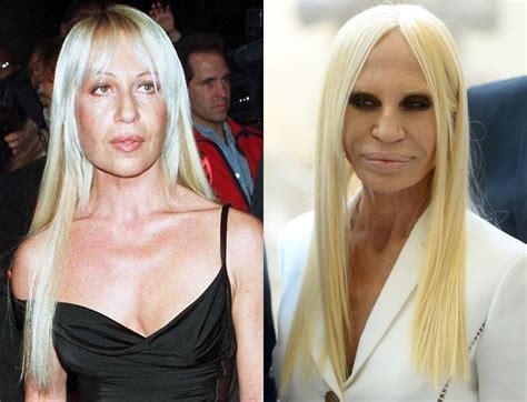 versace donatella plastic surgery|Here’s How Donatella Versace’s Plastic Surgery Transformed .